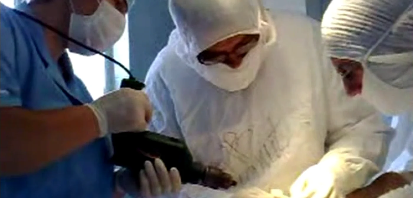 Medici cu bormaşina în mână, în timpul unei operaţii Captură pan.md