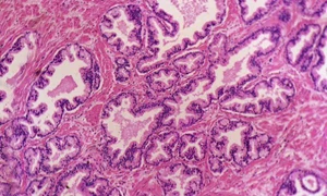 celule in sange 600x400 jpeg