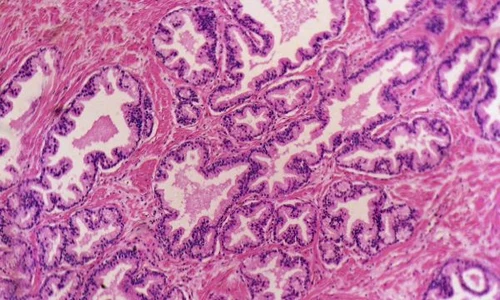 celule in sange 600x400 jpeg