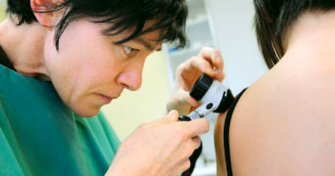 A fost creat un tratament promiţător pentru cancerul de piele