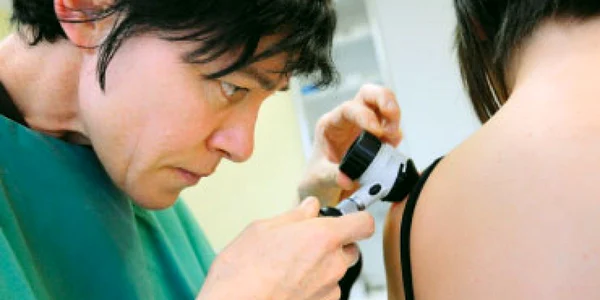 A fost creat un tratament promiţător pentru cancerul de piele