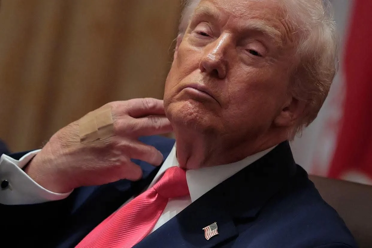 Donald Trump a apărut din nou cu un pansament la mâna dreaptă. Casa Albă are o explicație: „De la aspirină”