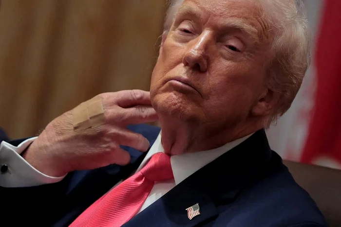 Donald Trump poartă un pasament pe mână FOTO: X