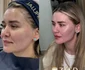 Alesia Mitriță, înainte și după intervenția estetică  Sursa/Zeedestethics