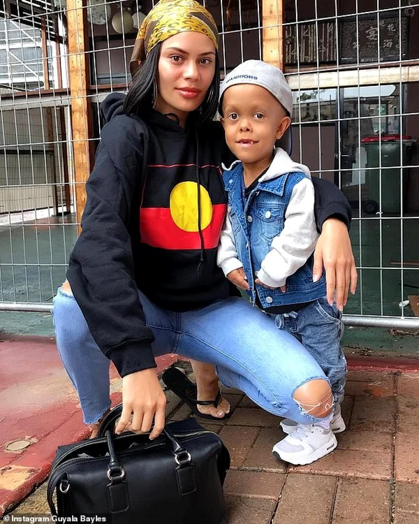Guyala şi Quaden Bayles FOTO Instagram