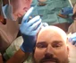 Nicu Grigore și-a făcut transplant de păr. foto: arhivă personală