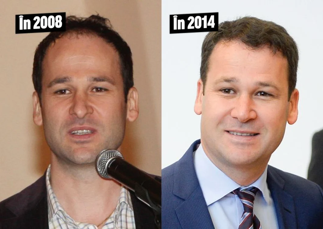 Medicul Youssef Chawi a explicat că primarul şi-a făcut rinoplastie şi injecţii cu botoxFoto: arhiva personală