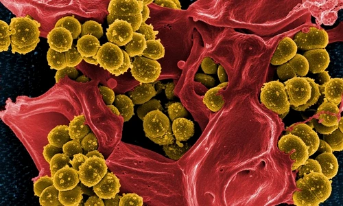 1 69237 original jpg jpeg