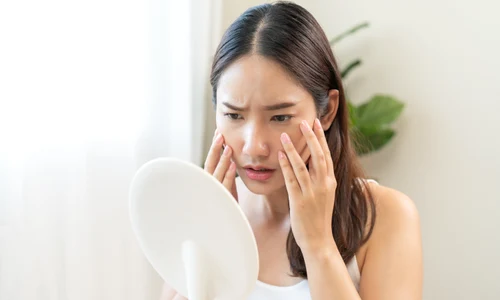 fata prosopagnozia jpg