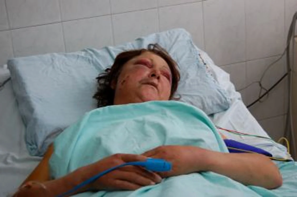 
    Florina Vlad, victima. Pe patul se spital, bătută, vânătă..  