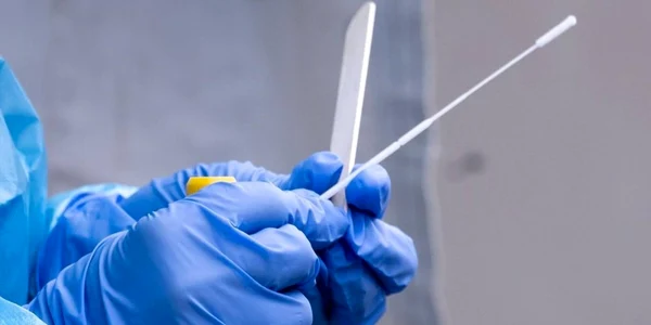 test antigen