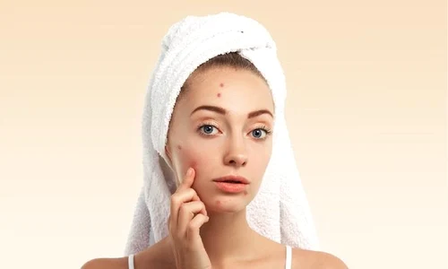 piele advertorial jpg