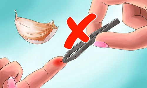 1 ti a intrat o aschie in deget uite cum sa o scoti cu usturoi j2sk jpg jpeg