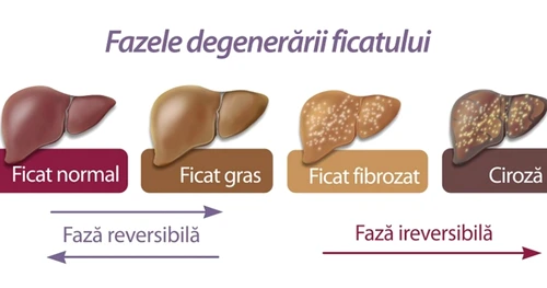 Alimente pentru ficat gras  Ce mănânci dacă ai această afecţiune png