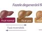 Alimente pentru ficat gras  Ce mănânci dacă ai această afecţiune png