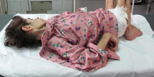 Gabriela Barna are șanse mari de supraviețuire