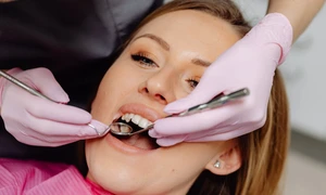 controlul placii bacterienii jpg