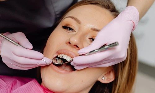 controlul placii bacterienii jpg