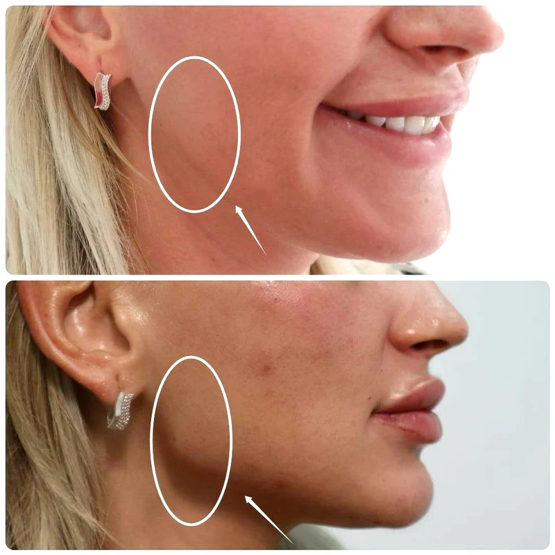 2 conturare mandibula dr iancu morad 2 jpg jpeg