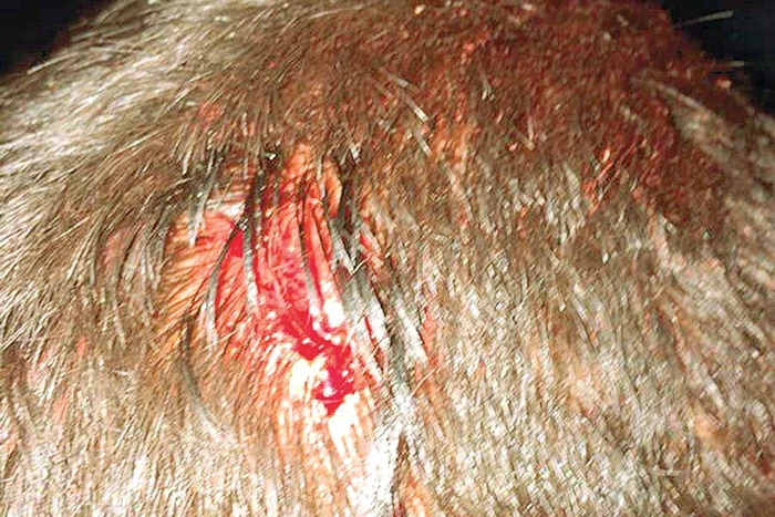 Mulţi suporteri au fost răniţi  de jandarmi (Fotografii: patraru.altphel.ro)