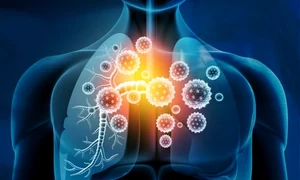 1 pneumologie jpg jpeg
