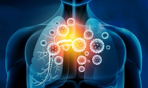 1 pneumologie jpg jpeg