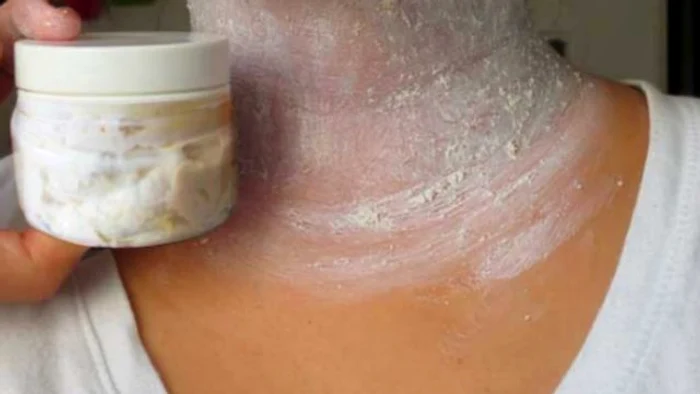 1 scapa de petele maro de pe piele cea mai eficienta metoda ucem jpg jpeg