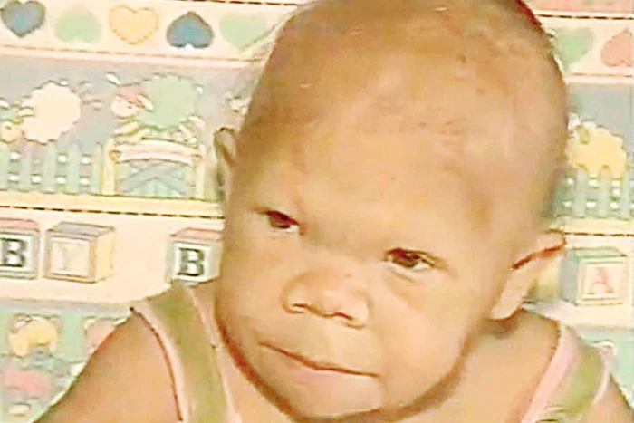 Nu merge şi nu vorbeşte şi trebuie îngrijită ca un nou-născut