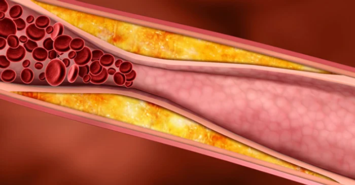 
    Senzaţia de amorţeală la nivelul picioarelor pot fi un semn că ai arterele înfundateclickpentrufemei.ro  
