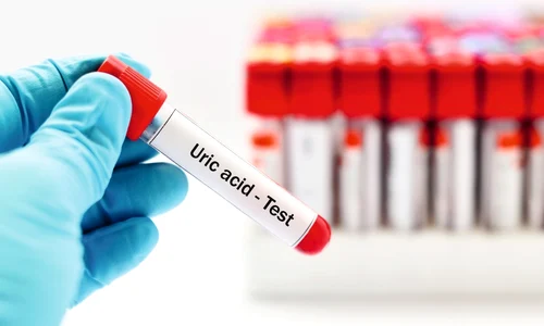 2 acid uric jpg jpeg