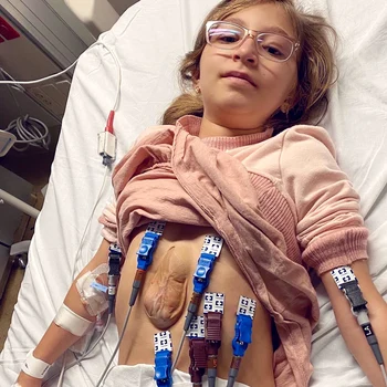 1 fetita cu inima in afara pieptului 11 ani 10 jpg jpeg