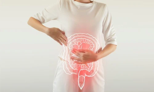 1 colon iritabil jpg jpeg