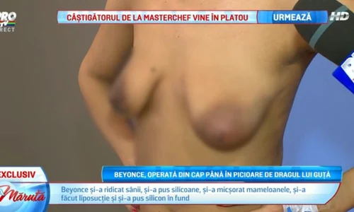 Beyonce de România a stat şapte ore în sala de operaţie jpeg