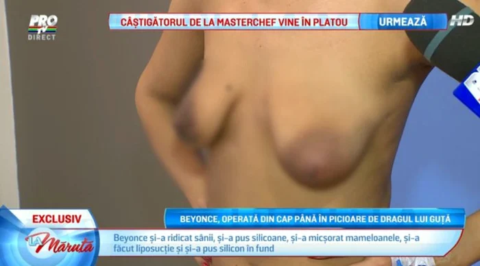 Beyonce de România a stat şapte ore în sala de operaţie