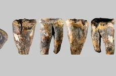 Molarul descoperit în Peștera Chagyrskaya și macro-caracteristicile sale (© Zubova et al., 2026, PLOS One, CC-BY 4)