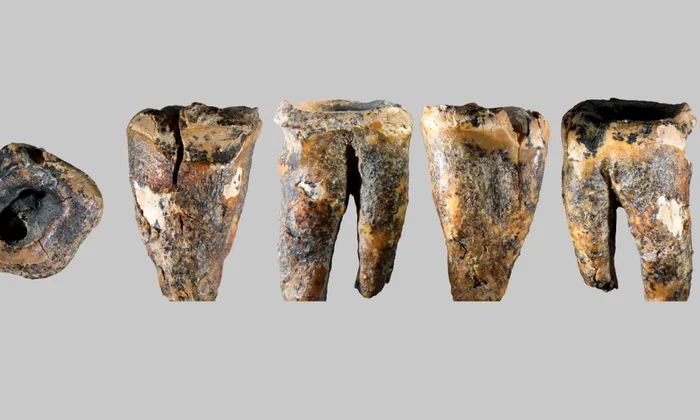 Molarul descoperit în Peștera Chagyrskaya și macro-caracteristicile sale (© Zubova et al., 2026, PLOS One, CC-BY 4)