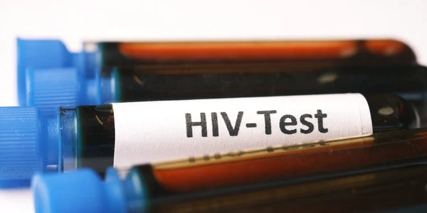 hiv pexels jpg