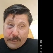 consilier AUR batut captura video Facebook jpg