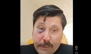 consilier AUR batut captura video Facebook jpg