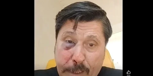 consilier AUR batut captura video Facebook jpg