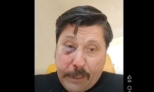 consilier AUR batut captura video Facebook jpg