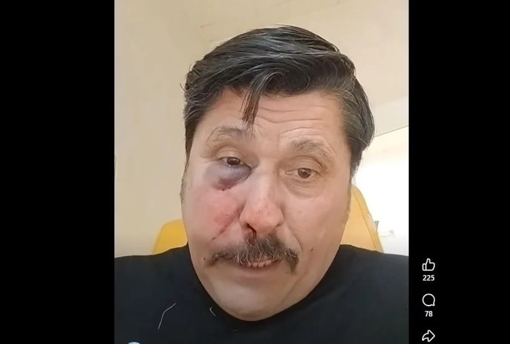 Un consilier local AUR acuză că a fost bătut crunt de doi colegi de la PSD şi PNL. „Au dat cu ură, să mă omoare. Loveau cu un sadism feroce”