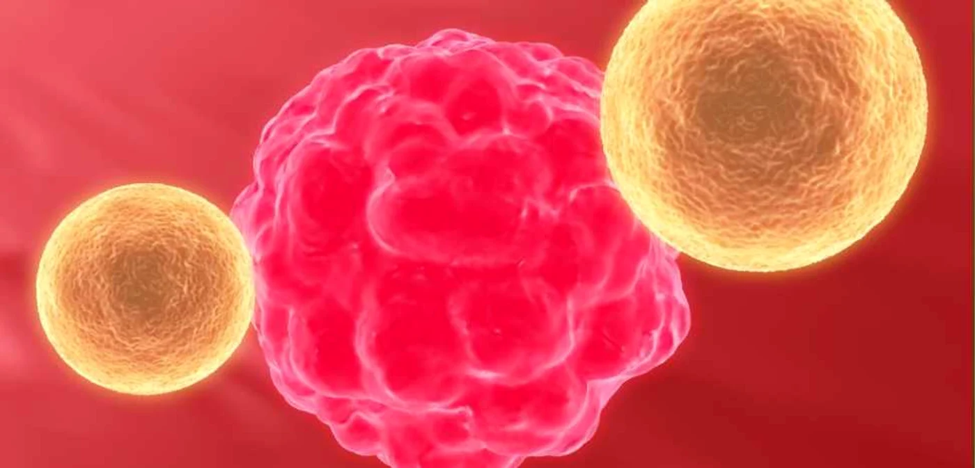 Testul de sânge ar putea ajuta la diagnosticarea timpurie a cancerului de piele. FOTO: Shutterstock.
