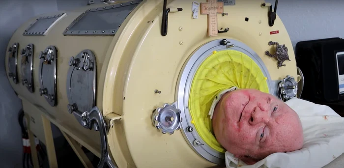 Paul Alexander a trăit într-un plămân de fier timp de 70 de ani (foto: captură video)