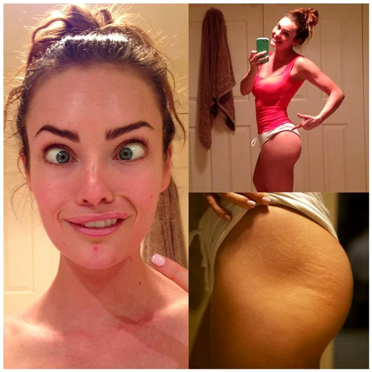 Emily Skye îşi arată micile imperfecţiuni