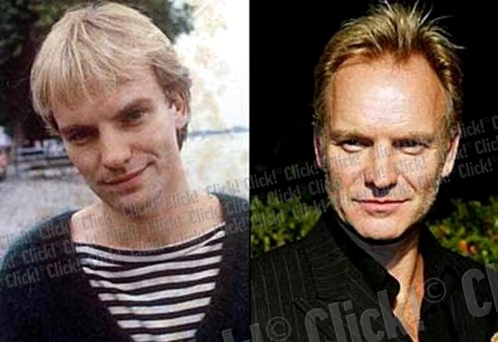 Sting