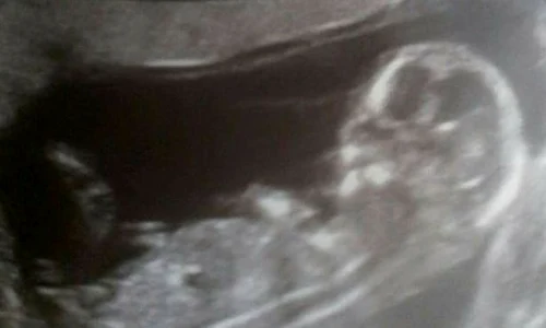 pareidolie 4 jpeg