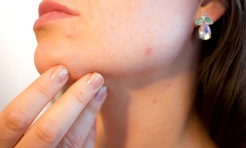 1 73199 original jpg jpeg