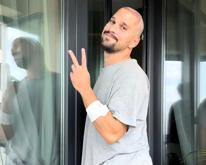 Vlad Gherman, implant de păr / Foto: Instagram