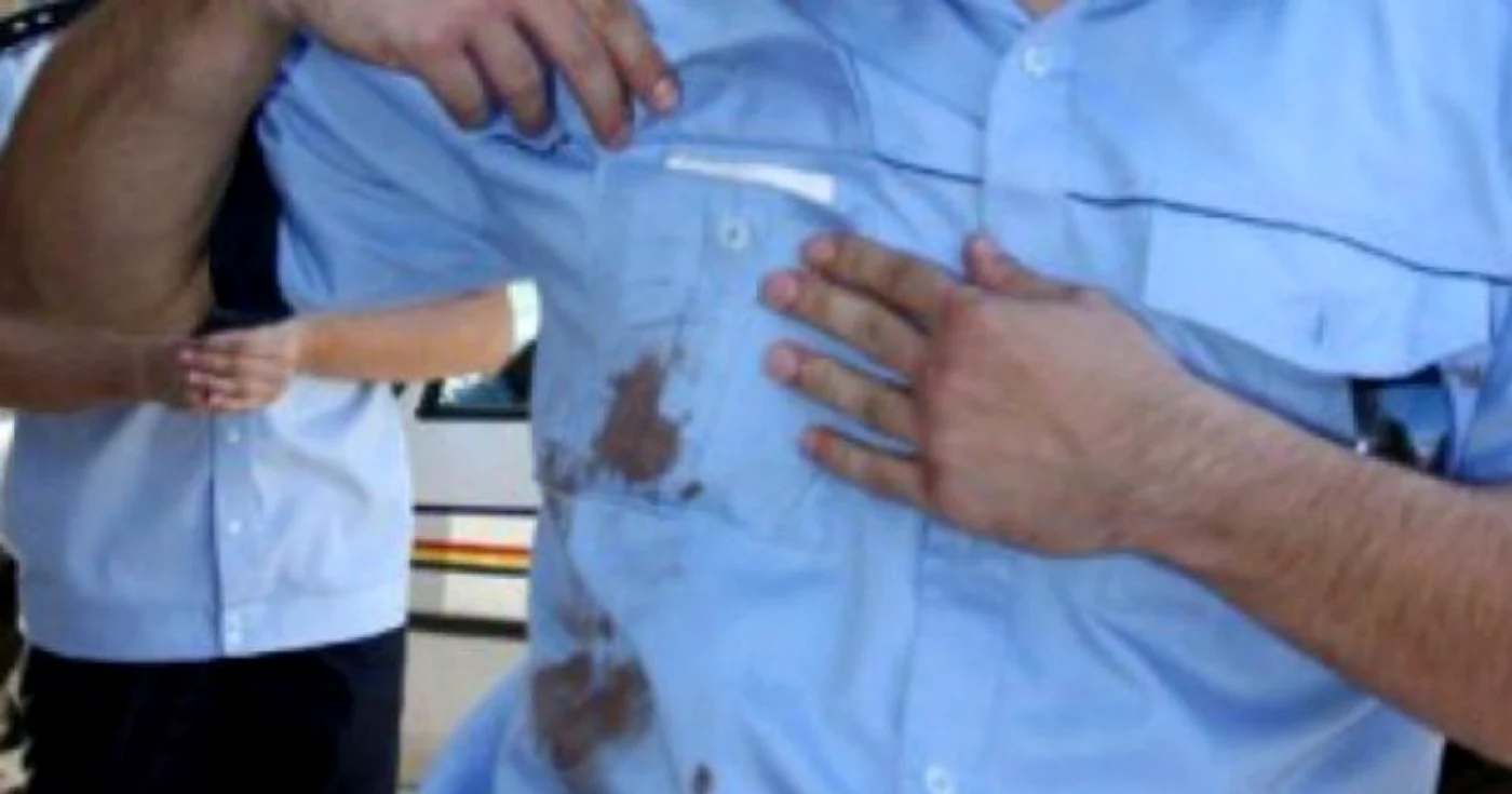 Poliţistul muşcat a avut nevoie de 90 de zile de îngrijiri medicale Foto: Arhiva